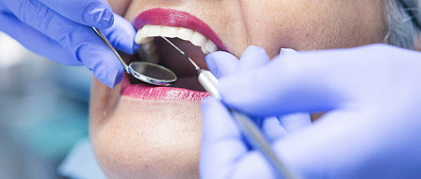 Best Emergency Treatment for Dental Infections or Abscesses in Lutz, FL